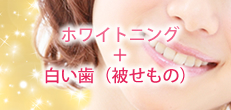 ホワイトニング+白い歯(被せもの)